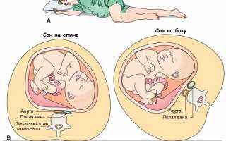Почему во время беременности нельзя спать на спине