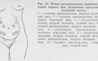 Аускультация во время беременности