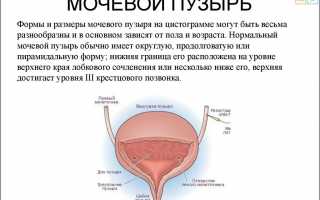 Как вылечить невроз мочевого пузыря